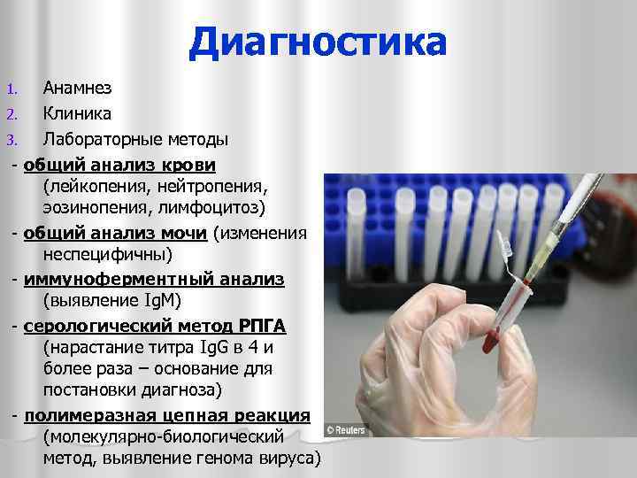 Диагностика Анамнез 2. Клиника 3. Лабораторные методы - общий анализ крови (лейкопения, нейтропения, эозинопения,