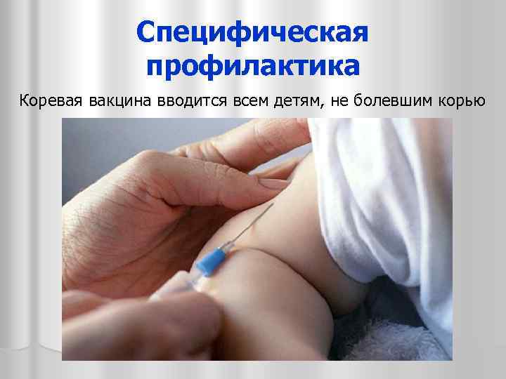 Специфическая профилактика Коревая вакцина вводится всем детям, не болевшим корью 