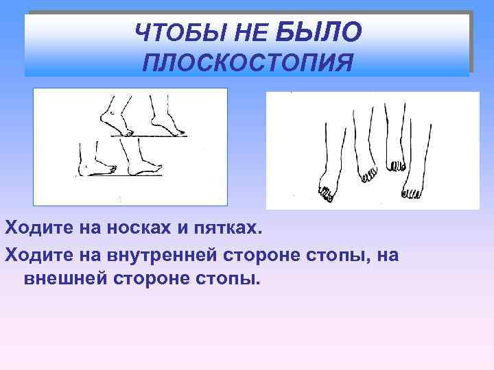 ЧТОБЫ НЕ БЫЛО ПЛОСКОСТОПИЯ Ходите на носках и пятках. Ходите на внутренней стороне стопы,