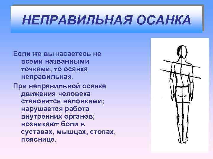 НЕПРАВИЛЬНАЯ ОСАНКА Если же вы касаетесь не всеми названными точками, то осанка неправильная. При