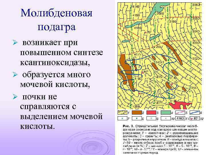 Молибденовая подагра возникает при повышенном синтезе ксантиноксидазы, Ø образуется много мочевой кислоты, Ø почки