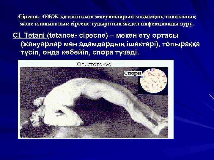 Сіреспе- ОЖЖ қозғалтқыш жасушаларын зақымдап, тоникалық және клоникалық сіреспе тудыратын жедел инфекционды ауру. Cl.