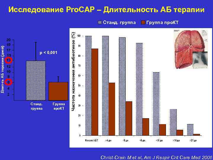 Исследование Pro. CAP – Длительность АБ терапии 20 19 17 15 13 p <