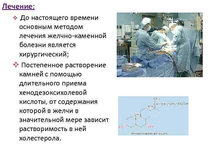 Лечение: До настоящего времени основным методом лечения желчно-каменной болезни является хирургический; v Постепенное растворение
