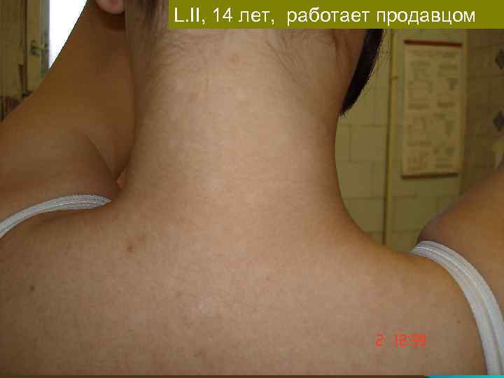 L. II, 14 лет, работает продавцом 