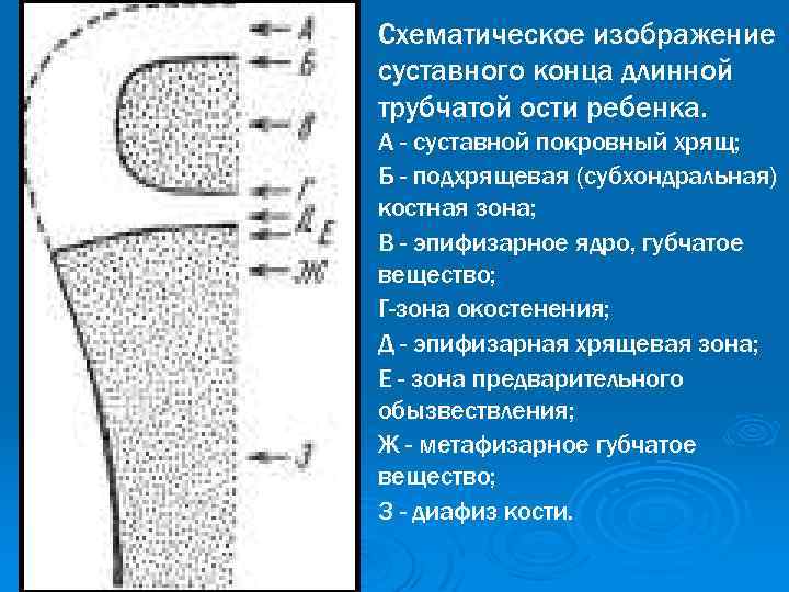 Схематическое изображение суставного конца длинной трубчатой ости ребенка. А - суставной покровный хрящ; Б