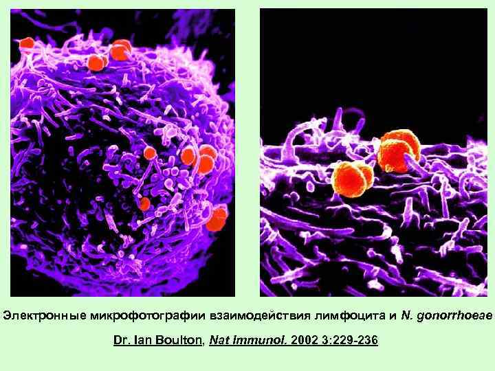 Электронные микрофотографии взаимодействия лимфоцита и N. gonorrhoeae Dr. Ian Boulton, Nat Immunol. 2002 3: