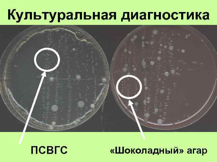 Культуральная диагностика ПСВГС «Шоколадный» агар 