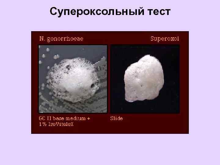 Супероксольный тест 