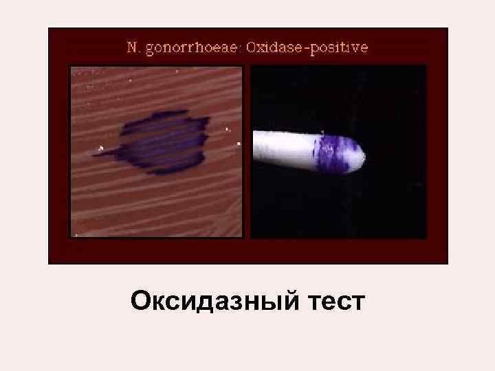 Оксидазный тест 