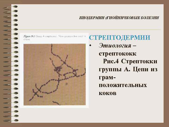 ПИОДЕРМИИ (ГНОЙНИЧКОВЫЕ БОЛЕЗНИ СТРЕПТОДЕРМИИ • Этиология – стрептококк Рис. 4 Стрептокки группы А. Цепи