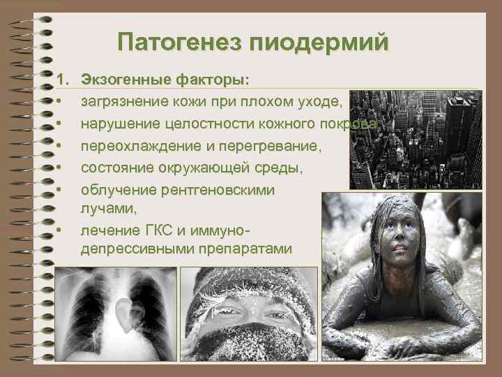 Патогенез пиодермий 1. • • • Экзогенные факторы: загрязнение кожи при плохом уходе, нарушение