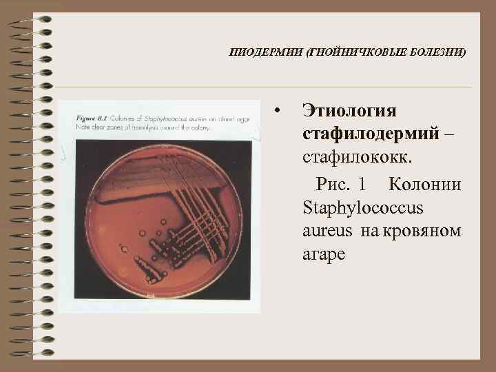 ПИОДЕРМИИ (ГНОЙНИЧКОВЫЕ БОЛЕЗНИ) • Этиология стафилодермий – стафилококк. Рис. 1 Колонии Staphylococcus aureus на