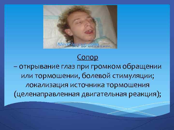 Сопор – открывание глаз при громком обращении или тормошении, болевой стимуляции; локализация источника тормошения