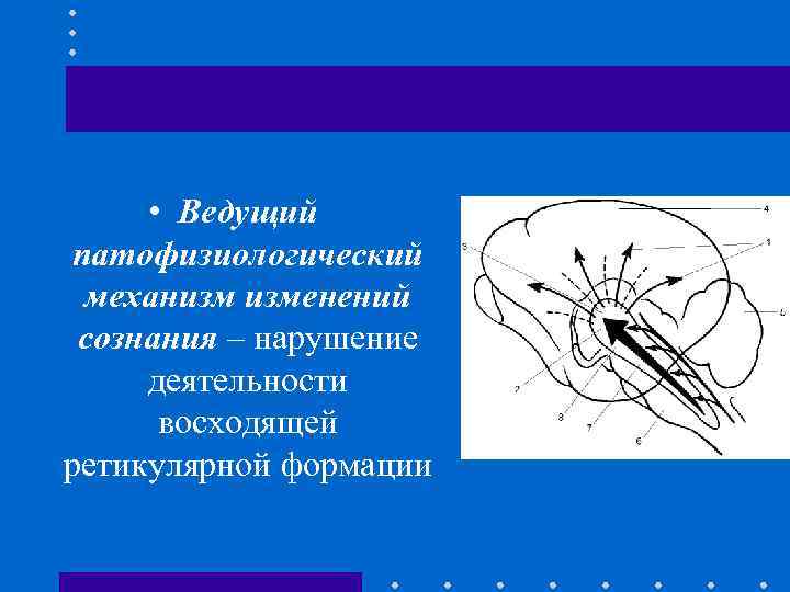  • Ведущий патофизиологический механизм изменений сознания – нарушение деятельности восходящей ретикулярной формации 