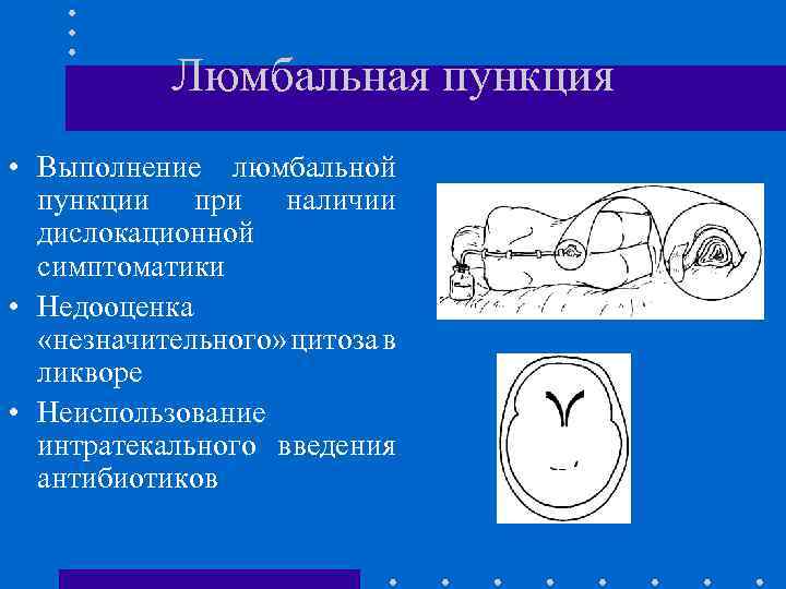 Люмбальная пункция • Выполнение люмбальной пункции при наличии дислокационной симптоматики • Недооценка «незначительного» цитоза