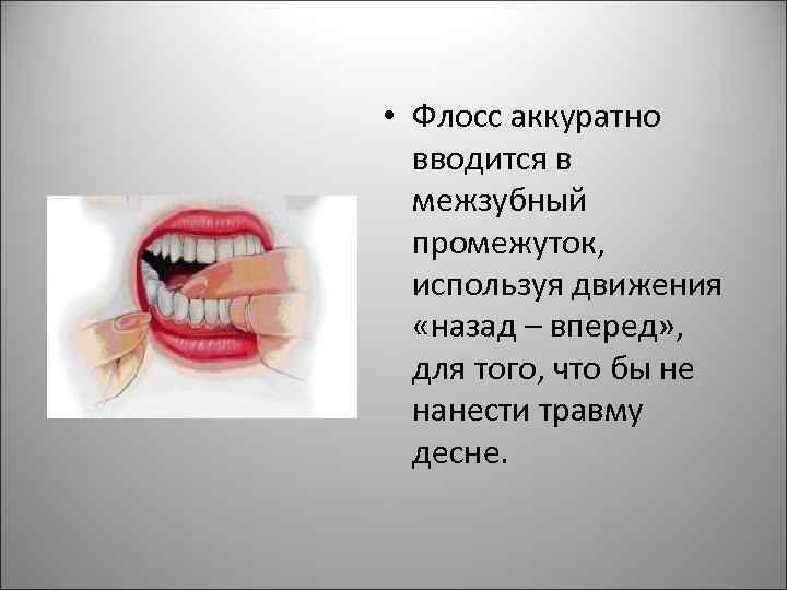  • Флосс аккуратно вводится в межзубный промежуток, используя движения «назад – вперед» ,