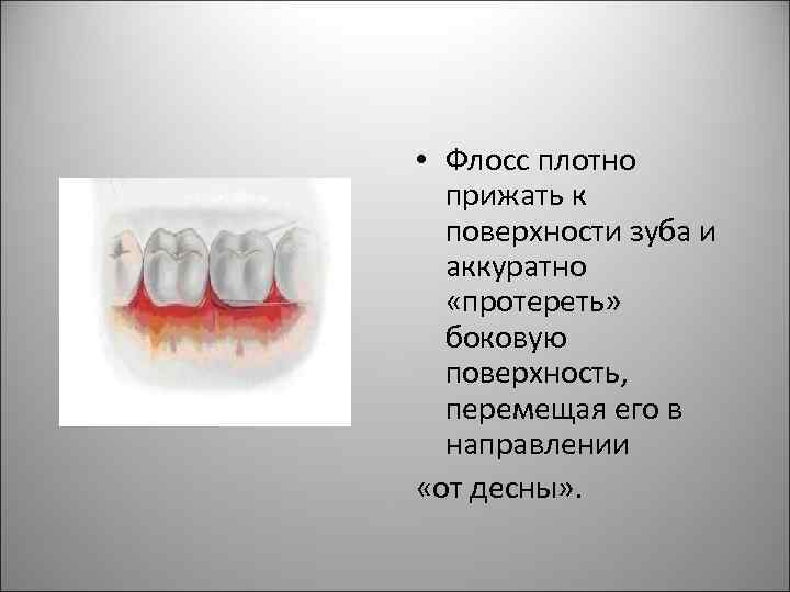 • Флосс плотно прижать к поверхности зуба и аккуратно «протереть» боковую поверхность, перемещая
