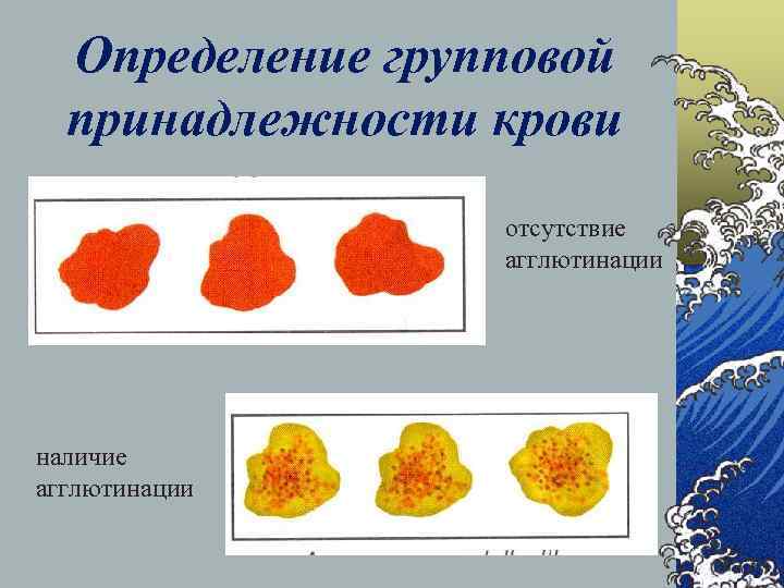 Определение групповой принадлежности крови отсутствие агглютинации наличие агглютинации 