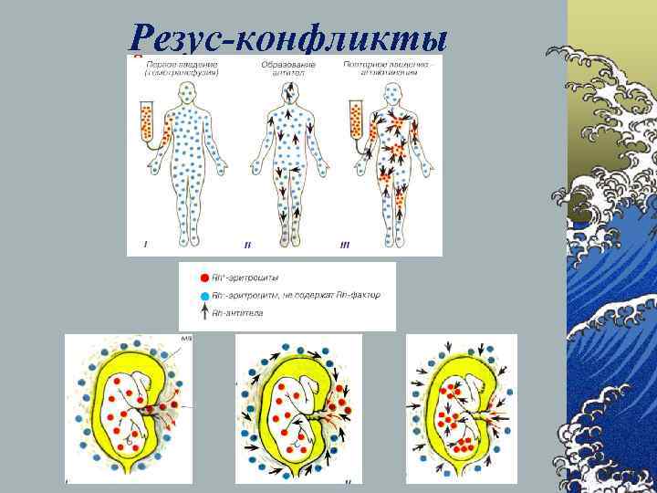 Резус-конфликты 