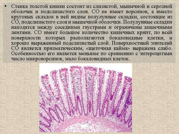 Бокаловидные клетки это