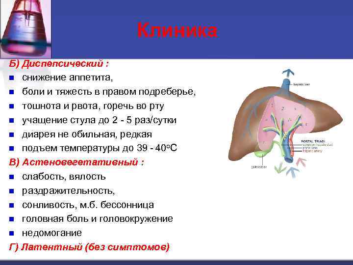 Клиника Б) Диспепсический : n снижение аппетита, n боли и тяжесть в правом подреберье,