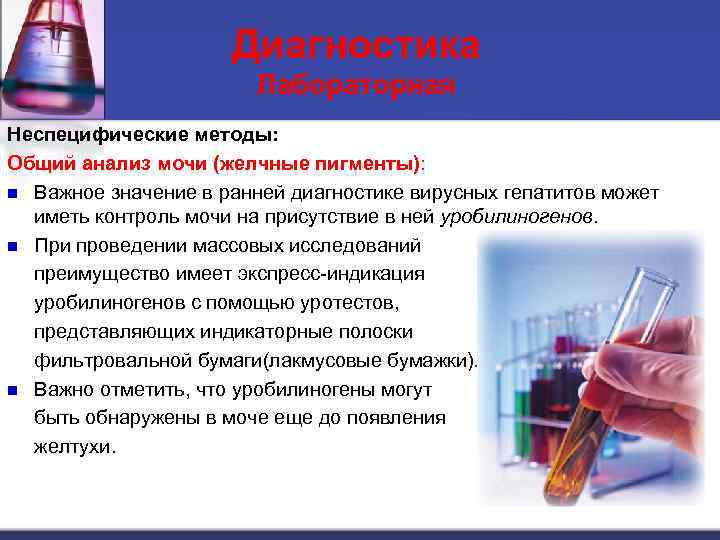 Диагностика Лабораторная Неспецифические методы: Общий анализ мочи (желчные пигменты): n Важное значение в ранней
