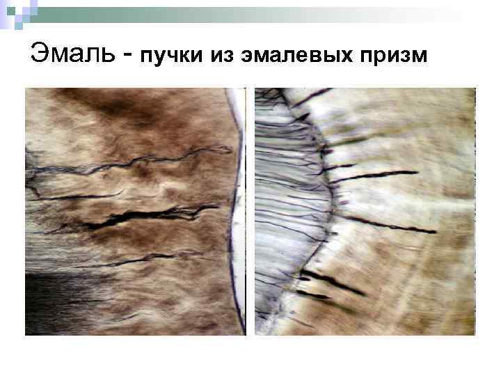 . Эмаль - пучки из эмалевых призм 