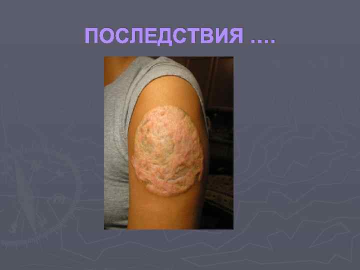 ПОСЛЕДСТВИЯ …. 