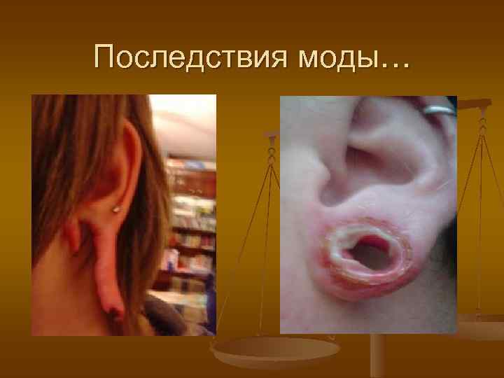 Последствия моды… 