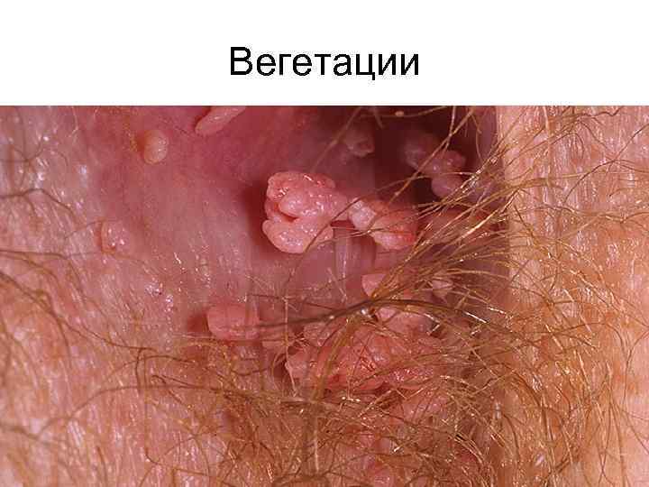 Вегетации 