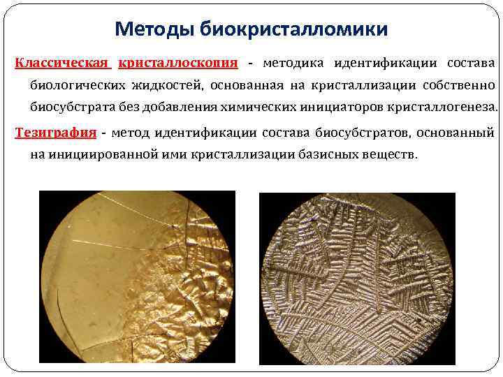 Методы биокристалломики Классическая кристаллоскопия методика идентификации состава биологических жидкостей, основанная на кристаллизации собственно биосубстрата