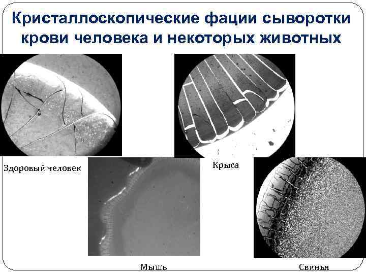 Кристаллоскопические фации сыворотки крови человека и некоторых животных Крыса Здоровый человек Мышь Свинья 