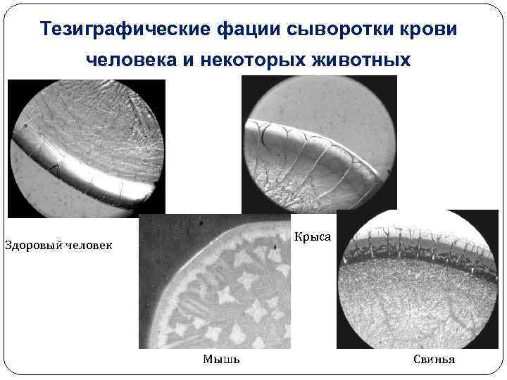 Тезиграфические фации сыворотки крови человека и некоторых животных Крыса Здоровый человек Мышь Свинья 