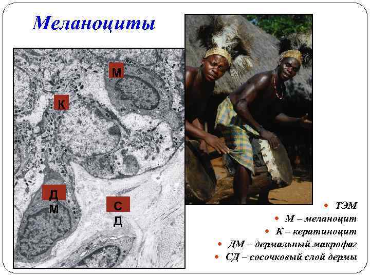 Меланоциты М К Д М С Д ТЭМ М – меланоцит К – кератиноцит