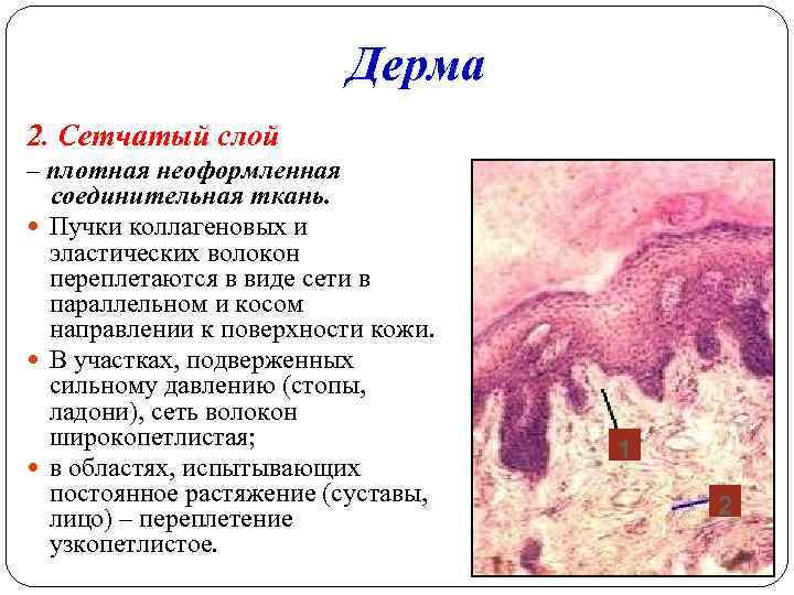 Дерма 2. Сетчатый слой – плотная неоформленная соединительная ткань. Пучки коллагеновых и эластических волокон