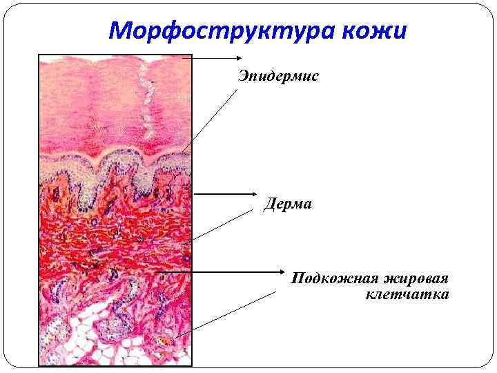 Морфоструктура кожи Эпидермис Дерма Подкожная жировая клетчатка 