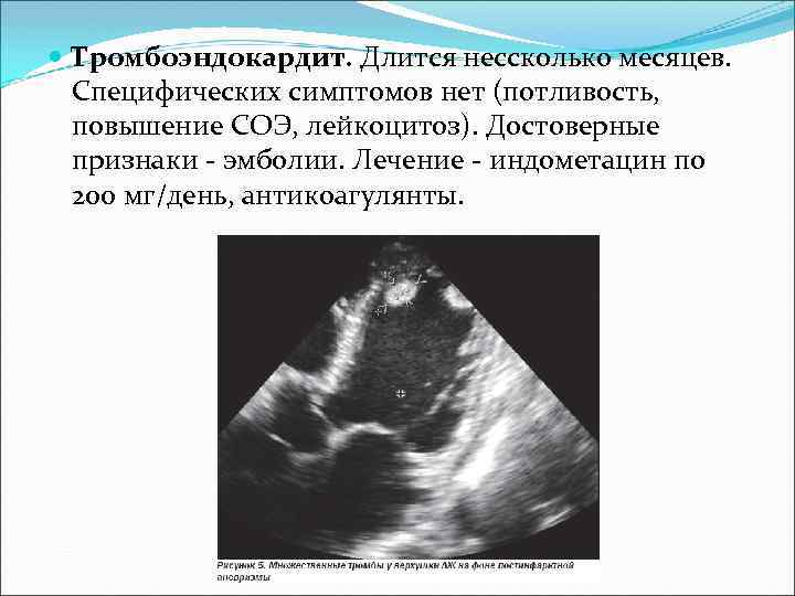 Тромбоэндокардит. Длится нессколько месяцев. Специфических симптомов нет (потливость, повышение СОЭ, лейкоцитоз). Достоверные признаки