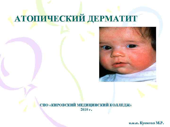 АТОПИЧЕСКИЙ ДЕРМАТИТ СПО «КИРОВСКИЙ МЕДИЦИНСКИЙ КОЛЛЕДЖ» 2010 г. к. м. н. Куимова М. Р.