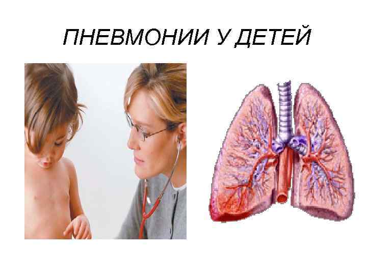 ПНЕВМОНИИ У ДЕТЕЙ 