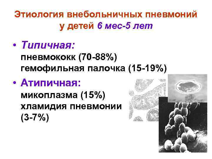 Этиология внебольничных пневмоний у детей 6 мес-5 лет • Типичная: пневмококк (70 -88%) гемофильная