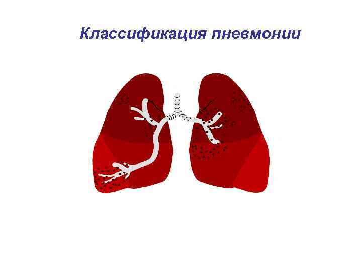 Классификация пневмонии 
