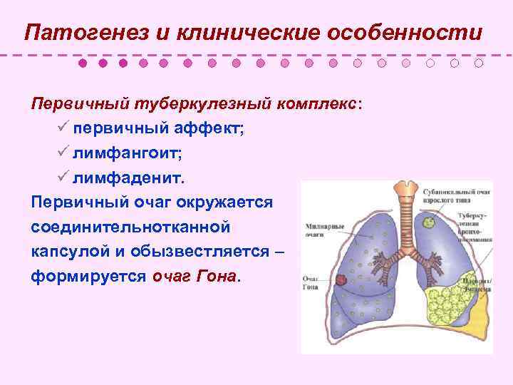 Патогенез и клинические особенности Первичный туберкулезный комплекс: ü первичный аффект; ü лимфангоит; ü лимфаденит.