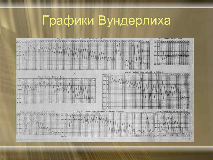 Графики Вундерлиха 
