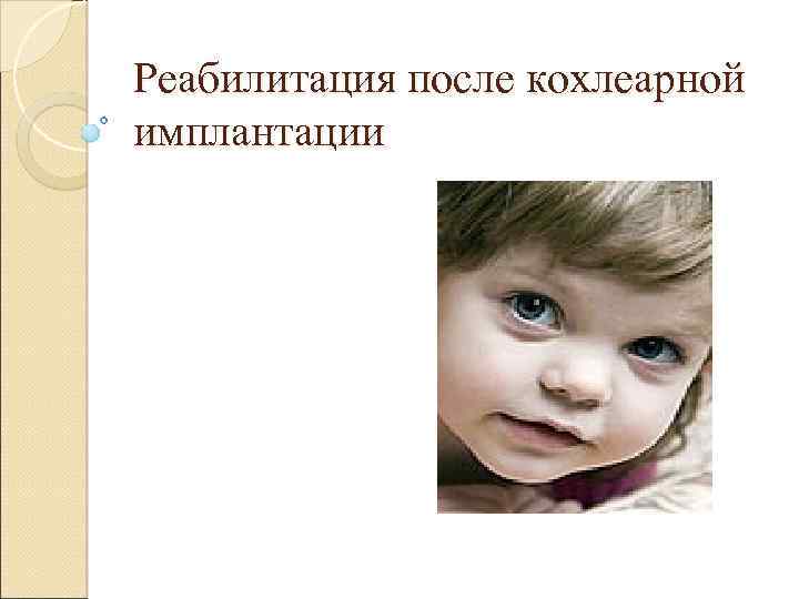 Реабилитация после кохлеарной имплантации 