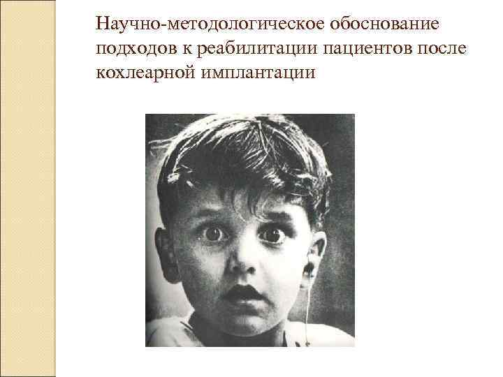 Научно-методологическое обоснование подходов к реабилитации пациентов после кохлеарной имплантации 