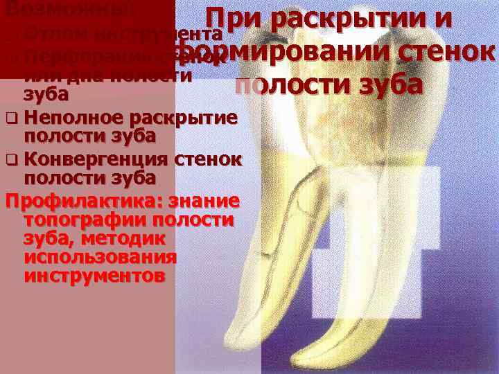 Возможны: При раскрытии и q Отлом инструмента формировании стенок q Перфорация стенок или дна