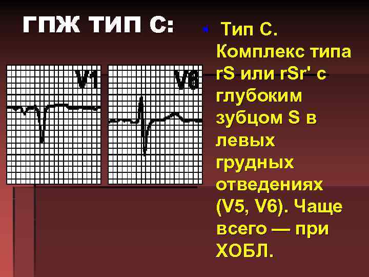 ГПЖ ТИП С: § Тип C. Комплекс типа r. S или r. Sr' с