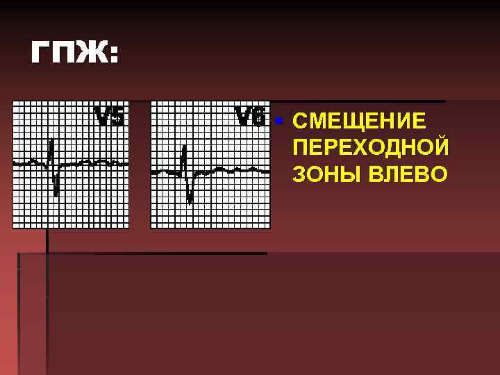 ГПЖ: § СМЕЩЕНИЕ ПЕРЕХОДНОЙ ЗОНЫ ВЛЕВО 