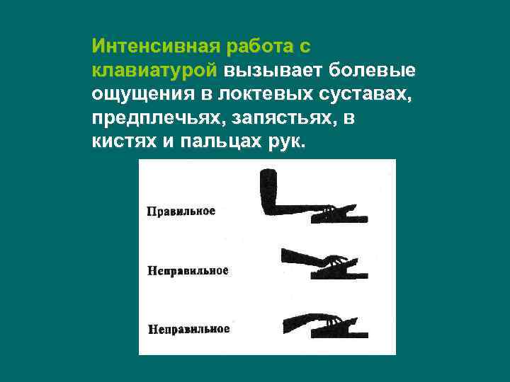Интенсивная работа с клавиатурой вызывает болевые ощущения в локтевых суставах, предплечьях, запястьях, в кистях